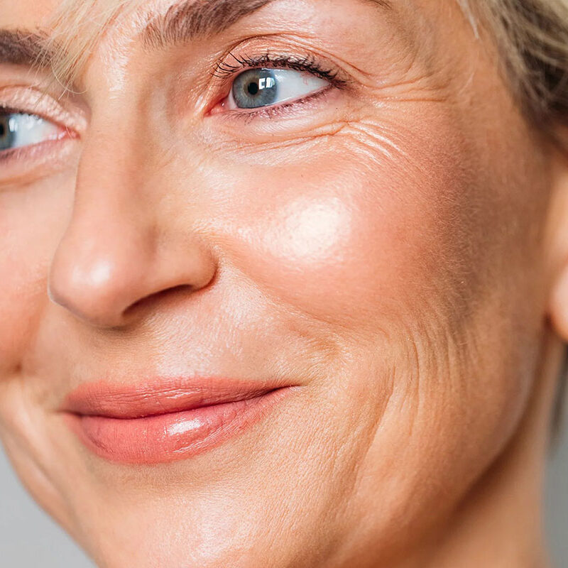 How Long Does It Take for Botox to Work