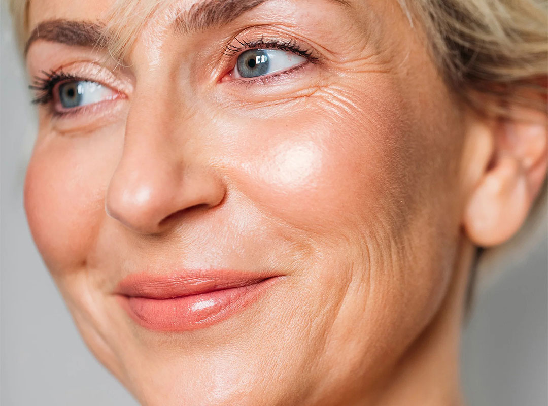 How Long Does It Take for Botox to Work?