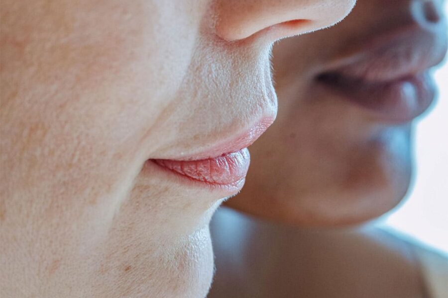 Lip+Filler+Superior,+CO,+Youthbar