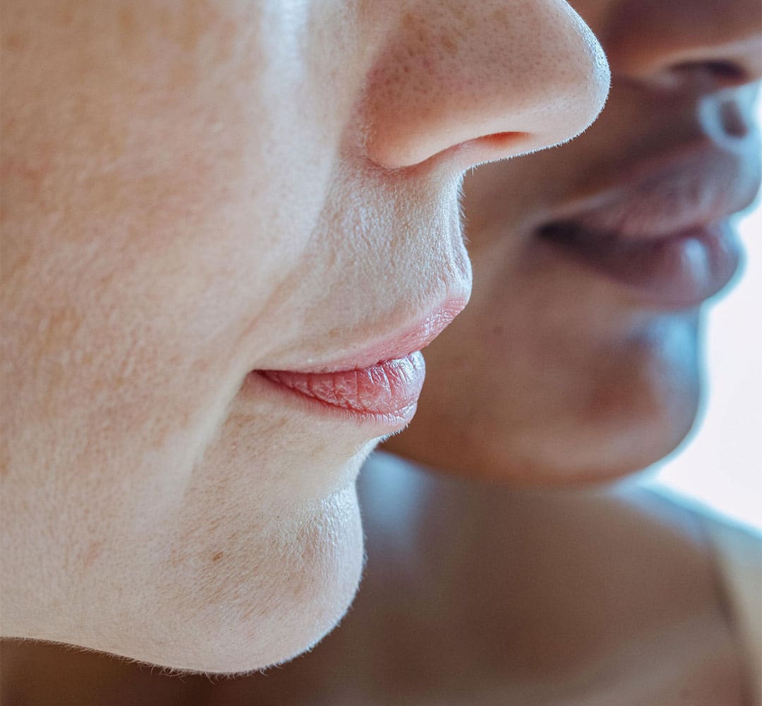 What NOT To Do After Lip Fillers