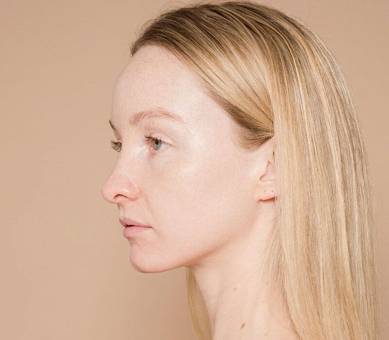 Sculptra+Superior,+CO,+Youthbar