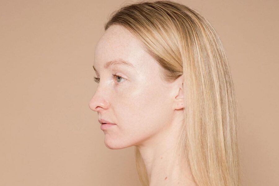 Sculptra+Superior,+CO,+Youthbar