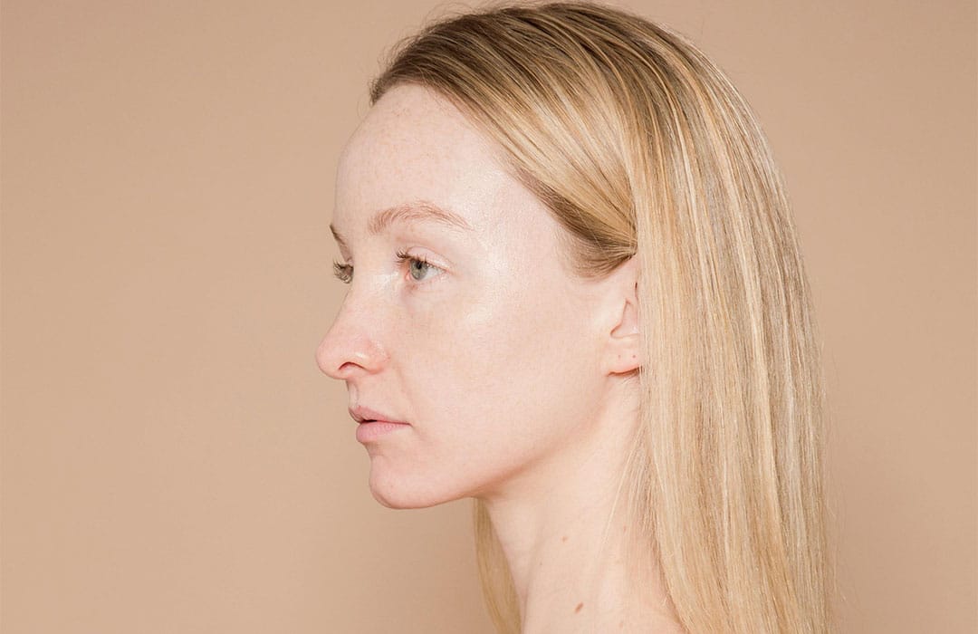 Sculptra Before and After–What’s the Difference?